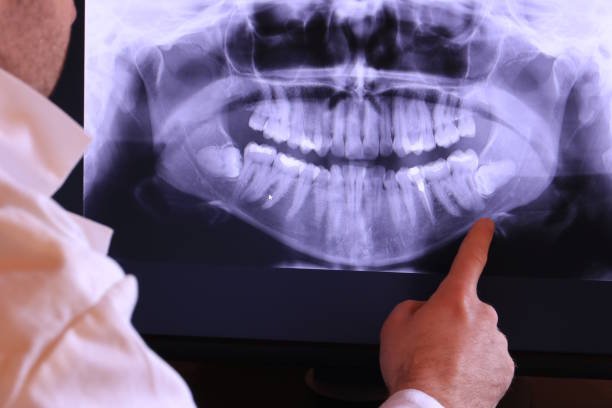 Best Cracked Tooth Emergency Dentist  in Aurora, TX